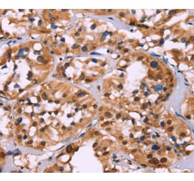 Immunohistochemistry - HIST1H1C Antibody from Signalway Antibody (35767) - Antibodies.com