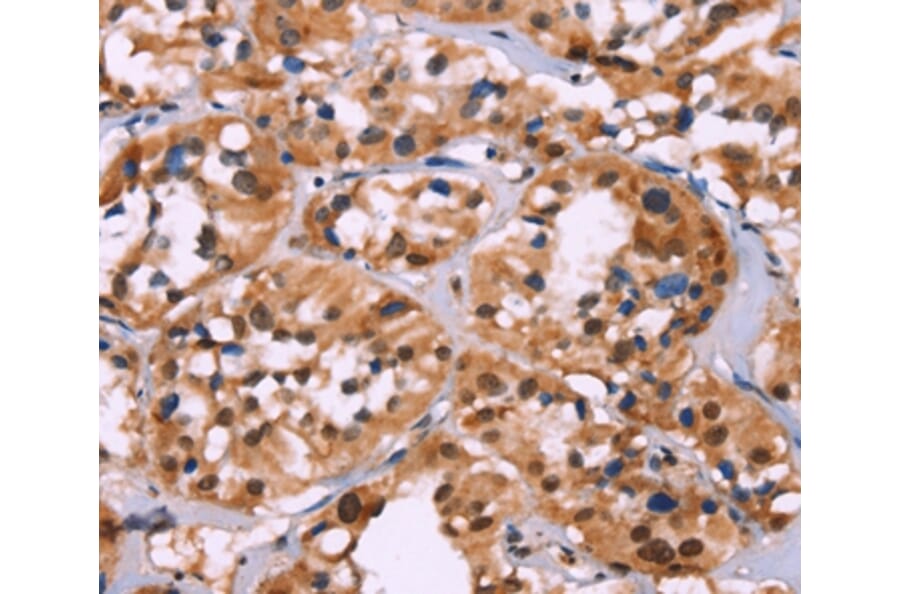 Immunohistochemistry - HIST1H1C Antibody from Signalway Antibody (35767) - Antibodies.com