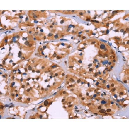 Immunohistochemistry - HIST1H1C Antibody from Signalway Antibody (35767) - Antibodies.com