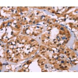 Immunohistochemistry - HIST1H1C Antibody from Signalway Antibody (35767) - Antibodies.com