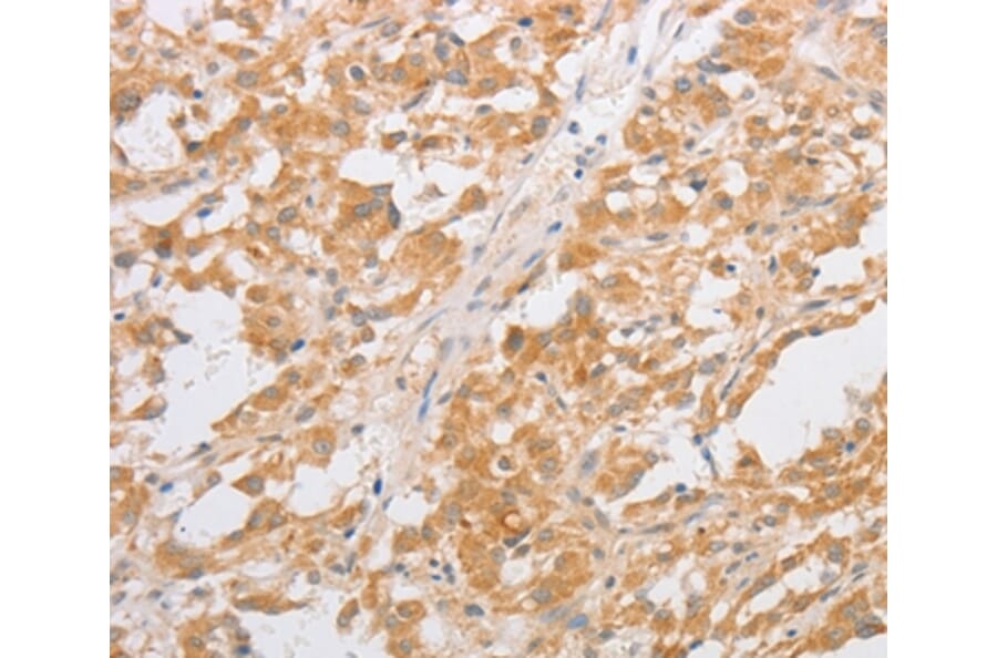 Immunohistochemistry - CDKN2AIP Antibody from Signalway Antibody (35855) - Antibodies.com