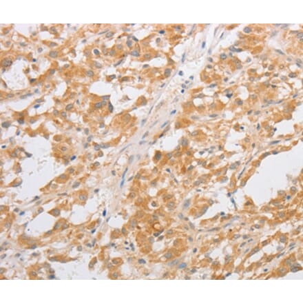 Immunohistochemistry - CDKN2AIP Antibody from Signalway Antibody (35855) - Antibodies.com