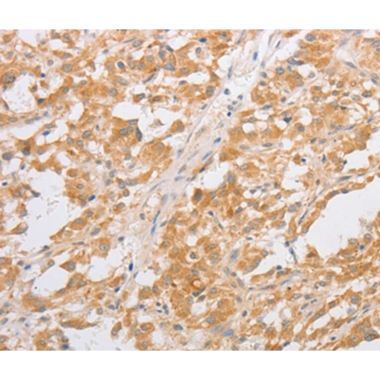 Immunohistochemistry - CDKN2AIP Antibody from Signalway Antibody (35855) - Antibodies.com