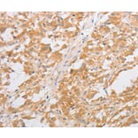 Immunohistochemistry - CDKN2AIP Antibody from Signalway Antibody (35855) - Antibodies.com