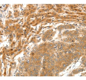 Immunohistochemistry - SERPINE1 Antibody from Signalway Antibody (35861) - Antibodies.com