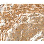 Immunohistochemistry - SERPINE1 Antibody from Signalway Antibody (35861) - Antibodies.com