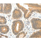 Immunohistochemistry - SERPINE1 Antibody from Signalway Antibody (35861) - Antibodies.com