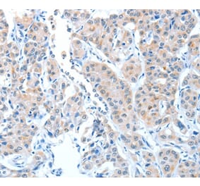 Immunohistochemistry - ADAMTSL1 Antibody from Signalway Antibody (36045) - Antibodies.com