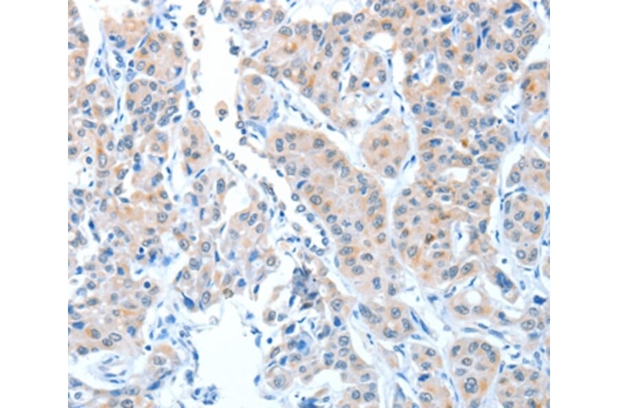 Immunohistochemistry - ADAMTSL1 Antibody from Signalway Antibody (36045) - Antibodies.com
