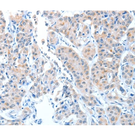 Immunohistochemistry - ADAMTSL1 Antibody from Signalway Antibody (36045) - Antibodies.com