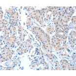 Immunohistochemistry - ADAMTSL1 Antibody from Signalway Antibody (36045) - Antibodies.com