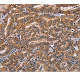 Immunohistochemistry - ADAMDEC1 Antibody from Signalway Antibody (36047) - Antibodies.com