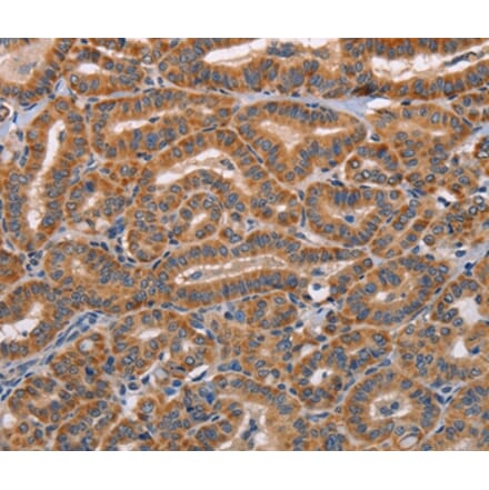 Immunohistochemistry - ADAMDEC1 Antibody from Signalway Antibody (36047) - Antibodies.com