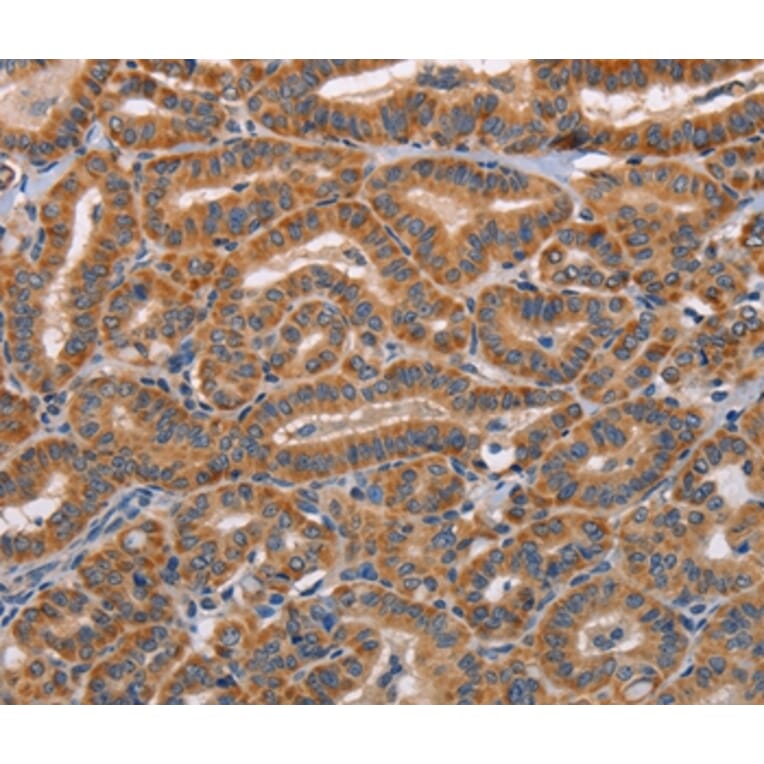 Immunohistochemistry - ADAMDEC1 Antibody from Signalway Antibody (36047) - Antibodies.com