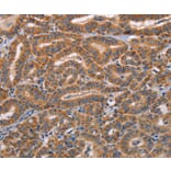 Immunohistochemistry - ADAMDEC1 Antibody from Signalway Antibody (36047) - Antibodies.com