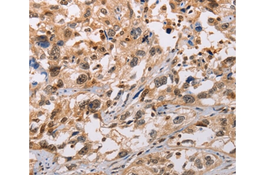 Immunohistochemistry - ADAMDEC1 Antibody from Signalway Antibody (36047) - Antibodies.com