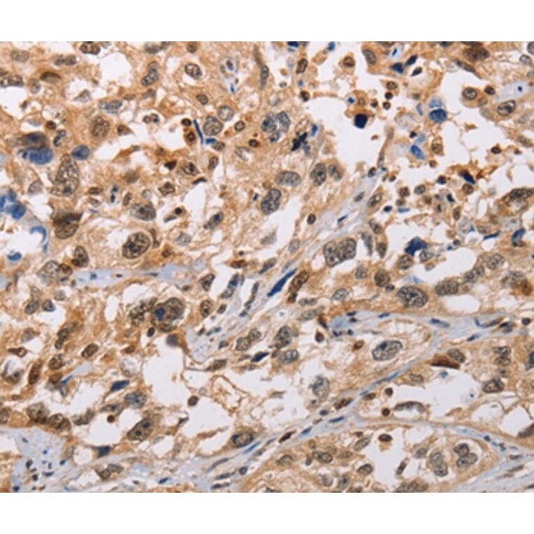 Immunohistochemistry - ADAMDEC1 Antibody from Signalway Antibody (36047) - Antibodies.com