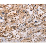 Immunohistochemistry - ADAMDEC1 Antibody from Signalway Antibody (36047) - Antibodies.com