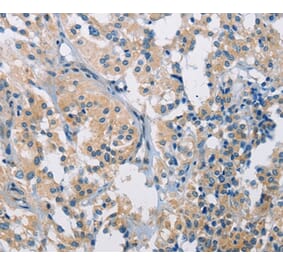 Immunohistochemistry - PDCD1LG2 Antibody from Signalway Antibody (36272) - Antibodies.com