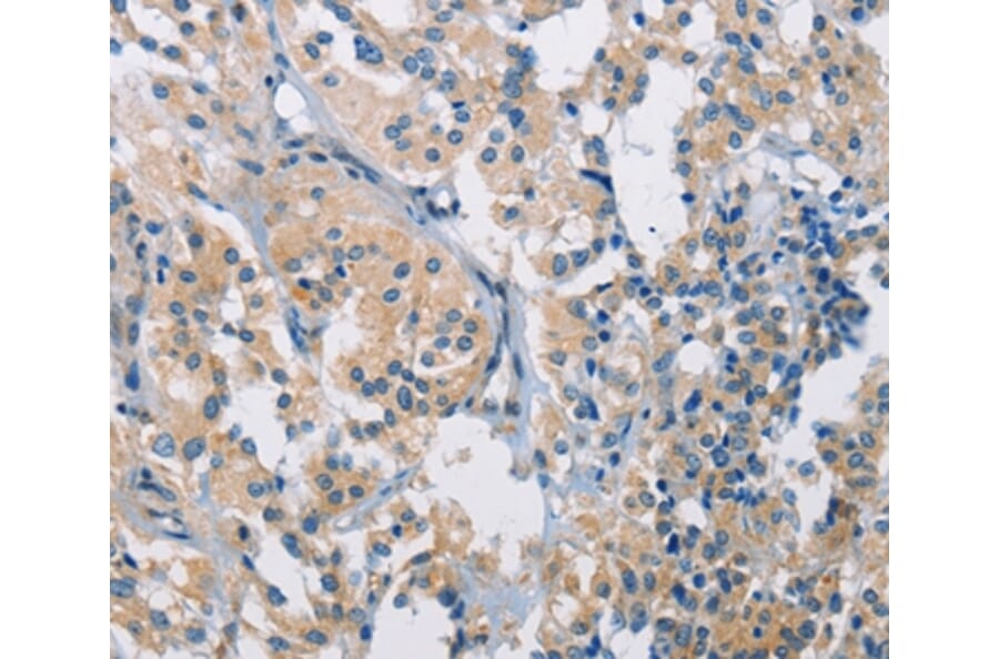 Immunohistochemistry - PDCD1LG2 Antibody from Signalway Antibody (36272) - Antibodies.com