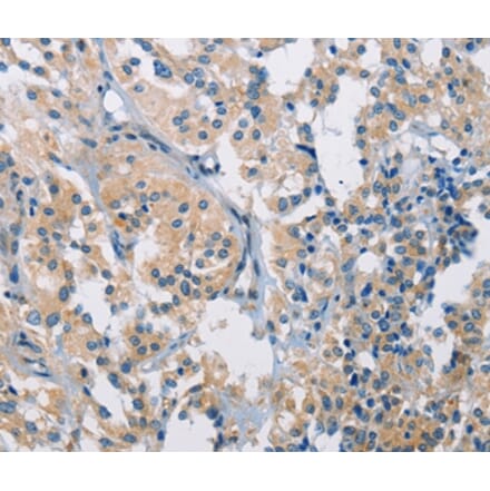 Immunohistochemistry - PDCD1LG2 Antibody from Signalway Antibody (36272) - Antibodies.com