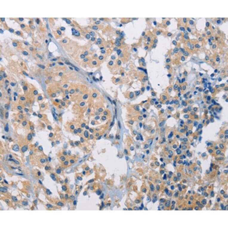 Immunohistochemistry - PDCD1LG2 Antibody from Signalway Antibody (36272) - Antibodies.com