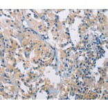 Immunohistochemistry - PDCD1LG2 Antibody from Signalway Antibody (36272) - Antibodies.com