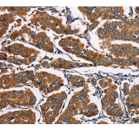 Immunohistochemistry - EIF4EBP2 Antibody from Signalway Antibody (36290) - Antibodies.com