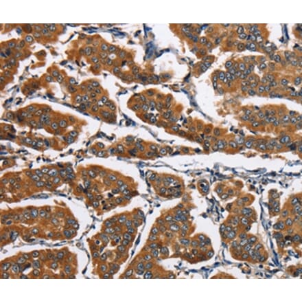 Immunohistochemistry - EIF4EBP2 Antibody from Signalway Antibody (36290) - Antibodies.com