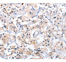 Immunohistochemistry - CATSPER1 Antibody from Signalway Antibody (36313) - Antibodies.com