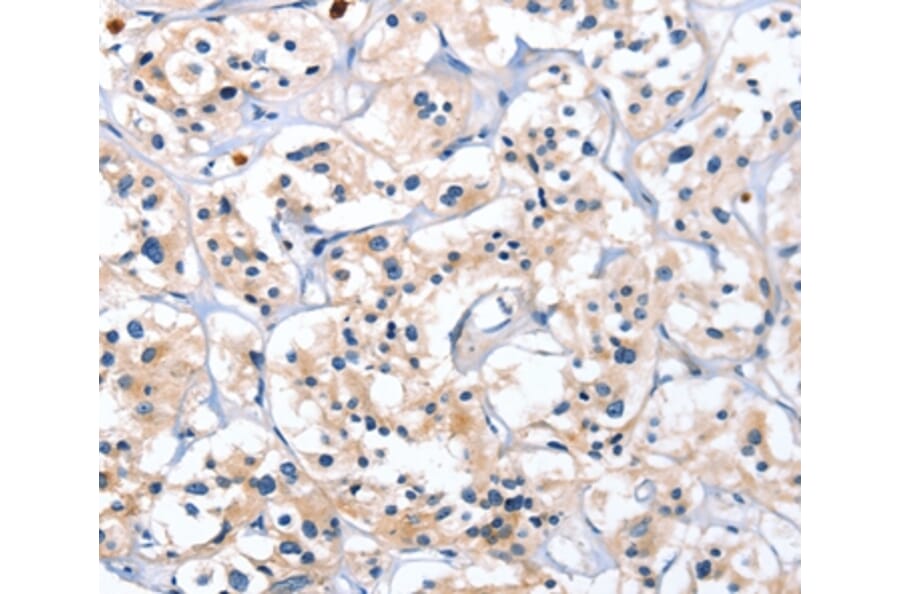 Immunohistochemistry - CATSPER1 Antibody from Signalway Antibody (36313) - Antibodies.com