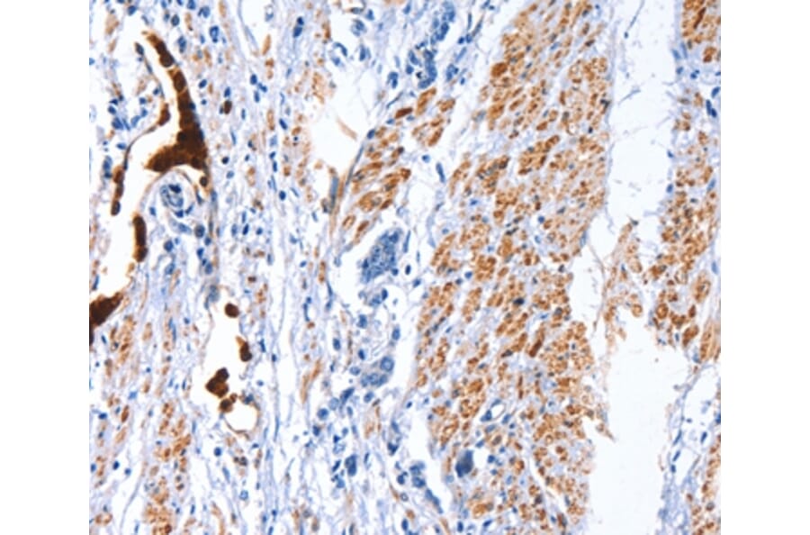 Immunohistochemistry - CATSPER1 Antibody from Signalway Antibody (36313) - Antibodies.com