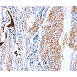 Immunohistochemistry - CATSPER1 Antibody from Signalway Antibody (36313) - Antibodies.com