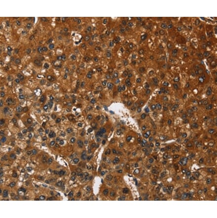 Immunohistochemistry - CATSPER4 Antibody from Signalway Antibody (36314) - Antibodies.com