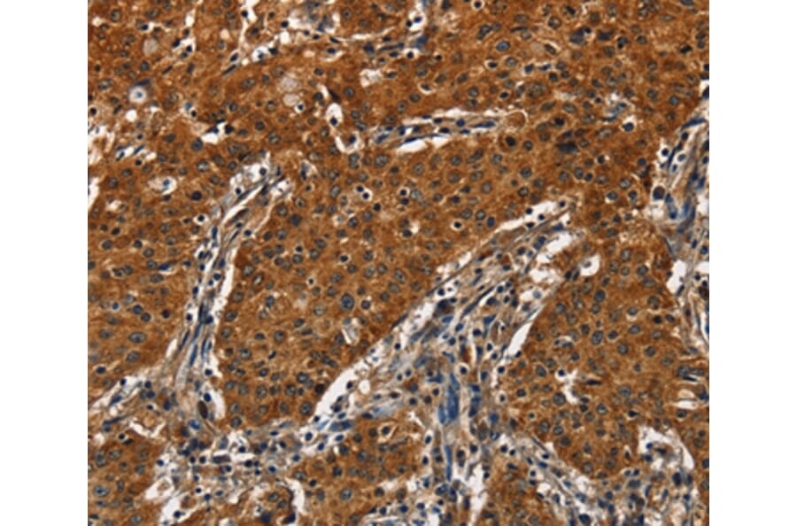Immunohistochemistry - CATSPER4 Antibody from Signalway Antibody (36314) - Antibodies.com