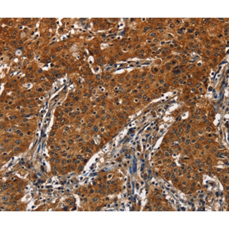 Immunohistochemistry - CATSPER4 Antibody from Signalway Antibody (36314) - Antibodies.com