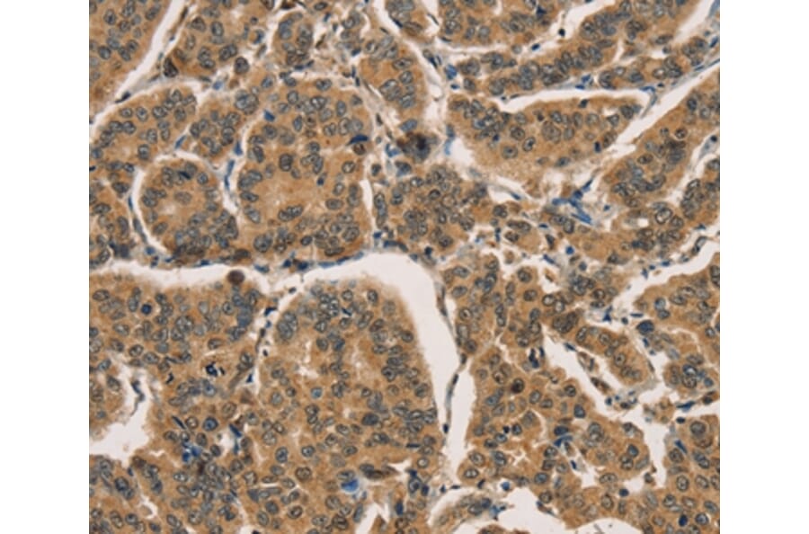 Immunohistochemistry - CTNNBIP1 Antibody from Signalway Antibody (36377) - Antibodies.com
