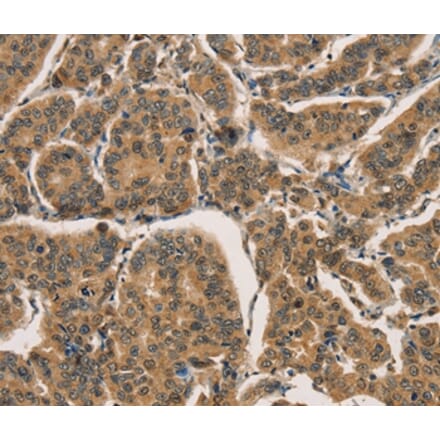 Immunohistochemistry - CTNNBIP1 Antibody from Signalway Antibody (36377) - Antibodies.com