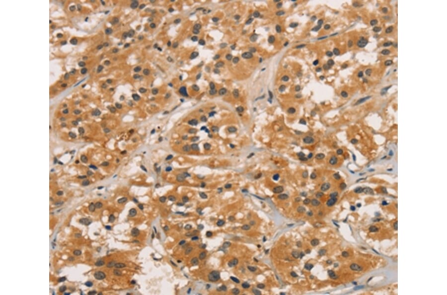 Immunohistochemistry - CTNNBIP1 Antibody from Signalway Antibody (36377) - Antibodies.com