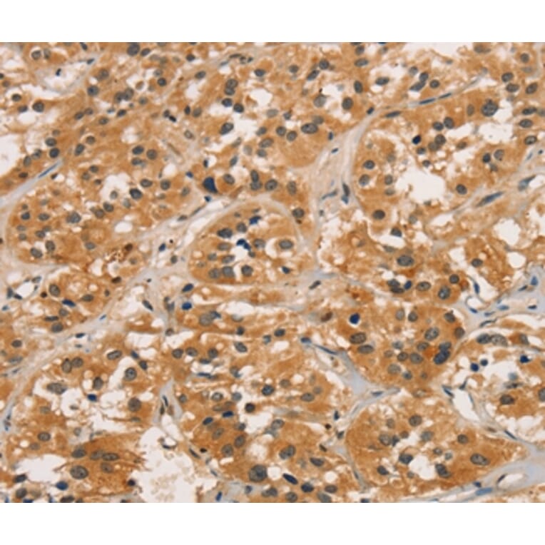 Immunohistochemistry - CTNNBIP1 Antibody from Signalway Antibody (36377) - Antibodies.com