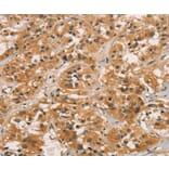 Immunohistochemistry - CTNNBIP1 Antibody from Signalway Antibody (36377) - Antibodies.com