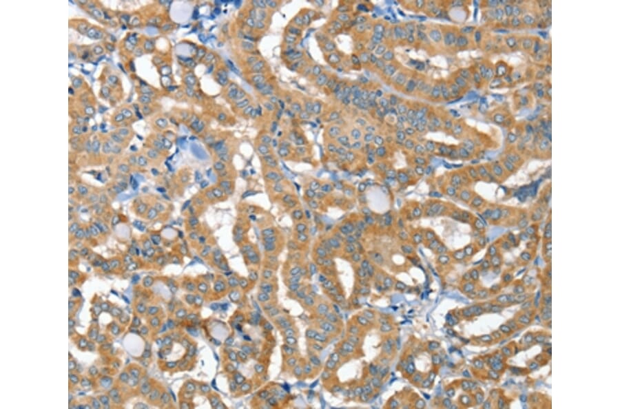Immunohistochemistry - TNFRSF21 Antibody from Signalway Antibody (36422) - Antibodies.com