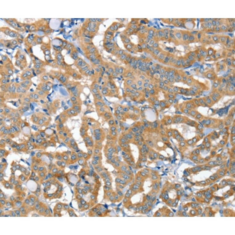 Immunohistochemistry - TNFRSF21 Antibody from Signalway Antibody (36422) - Antibodies.com