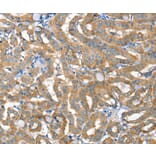 Immunohistochemistry - TNFRSF21 Antibody from Signalway Antibody (36422) - Antibodies.com