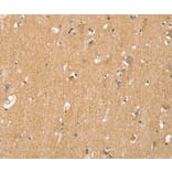 Immunohistochemistry - TNFRSF21 Antibody from Signalway Antibody (36422) - Antibodies.com