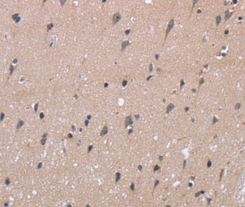 Immunohistochemical analysis of paraffin-embedded Human brain tissue using #36440 at dilution 1/40.