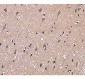 Immunohistochemistry - KIAA1324 Antibody from Signalway Antibody (36440) - Antibodies.com