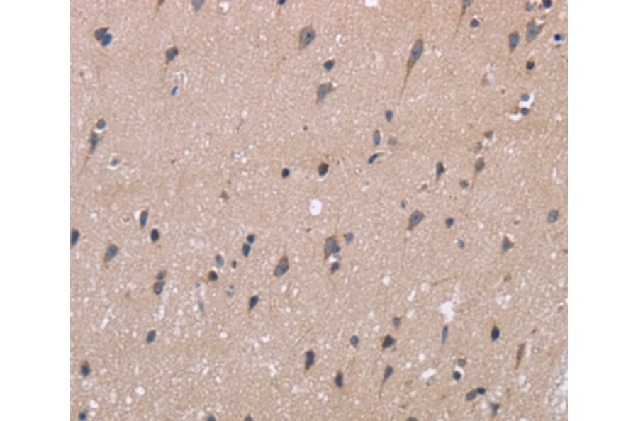 Immunohistochemistry - KIAA1324 Antibody from Signalway Antibody (36440) - Antibodies.com