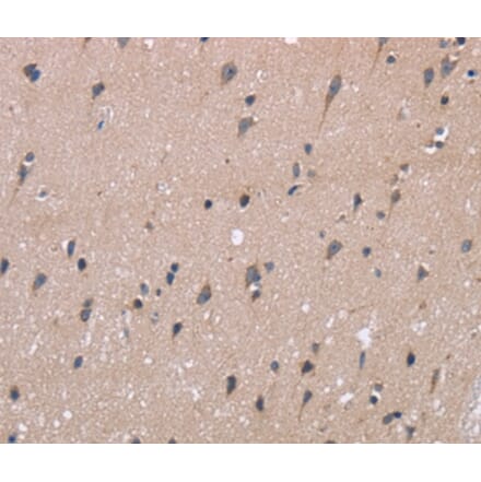 Immunohistochemistry - KIAA1324 Antibody from Signalway Antibody (36440) - Antibodies.com