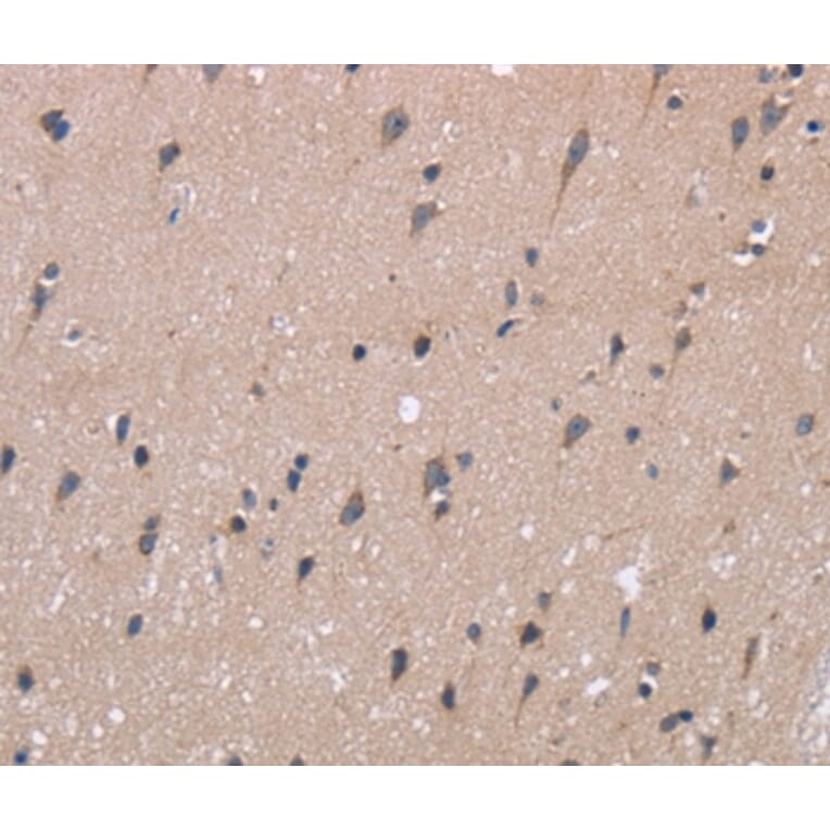 Immunohistochemistry - KIAA1324 Antibody from Signalway Antibody (36440) - Antibodies.com
